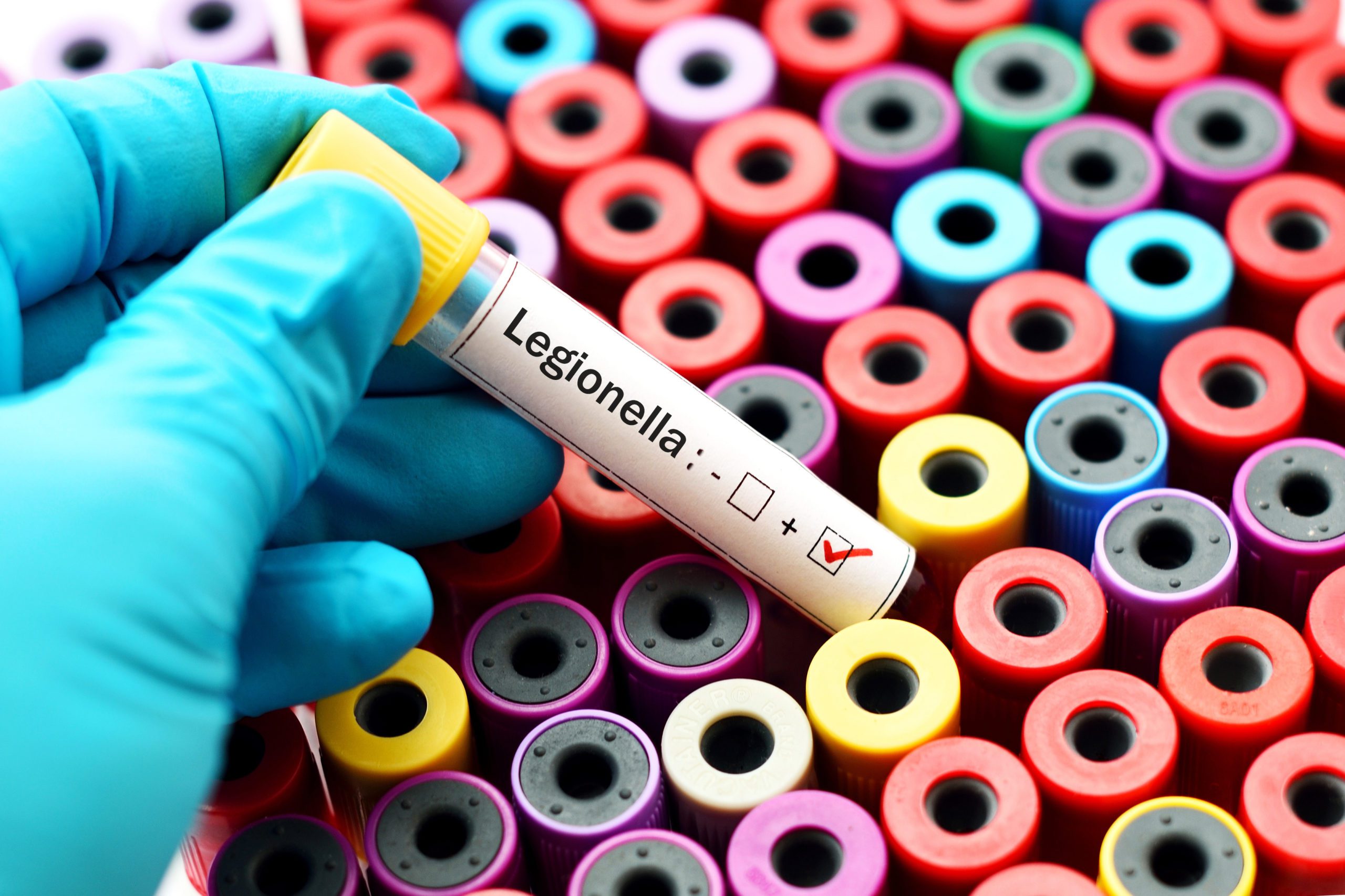 Featured Image for “For Landlords: How to Conduct a Legionella Risk Assessment”